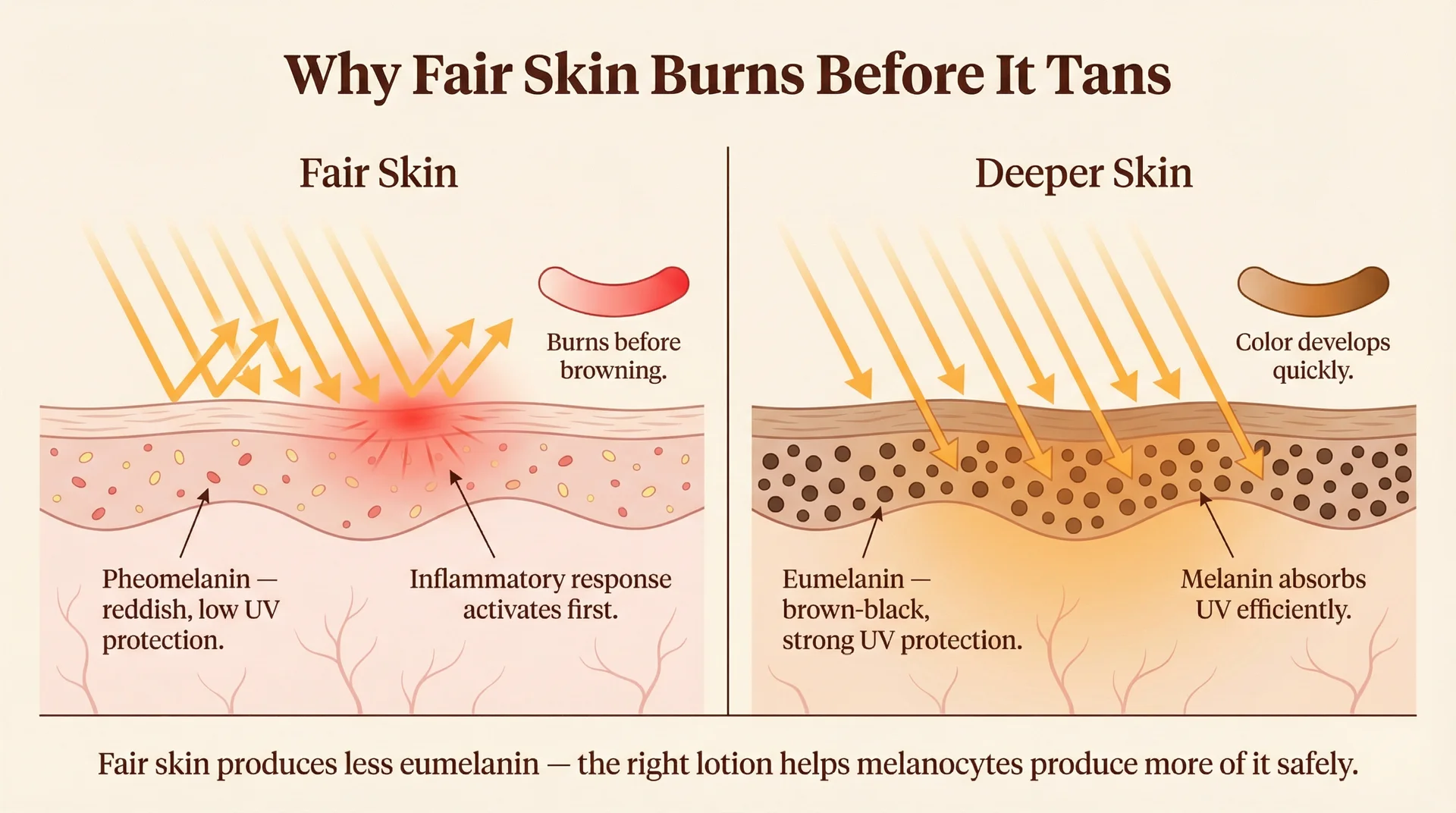 Side-by-side diagram comparing pheomelanin in fair skin versus eumelanin in deeper skin, explaining why fair skin burns before it tans and how tanning lotion supports melanin production