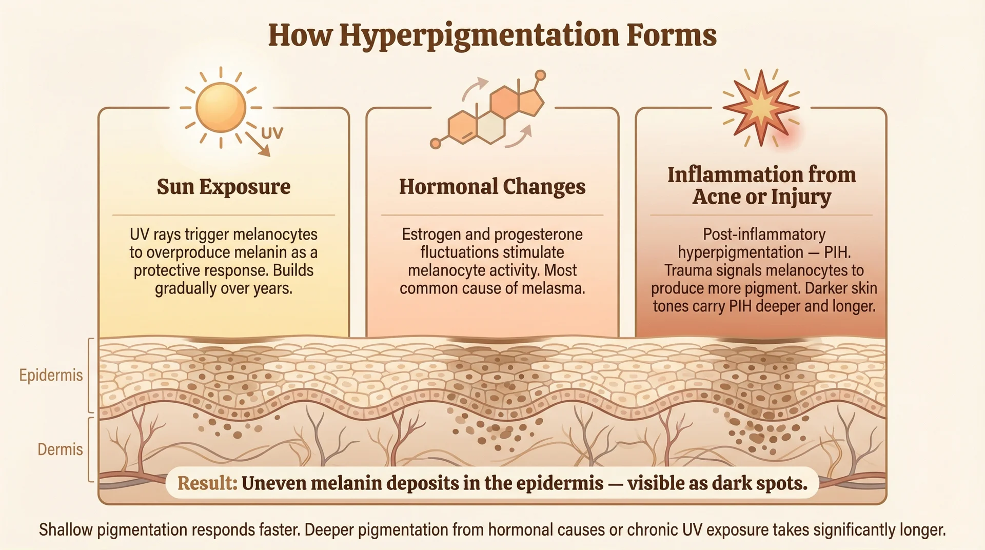 Three-panel diagram showing the three causes of hyperpigmentation — sun exposure, hormonal changes, and post-inflammatory response