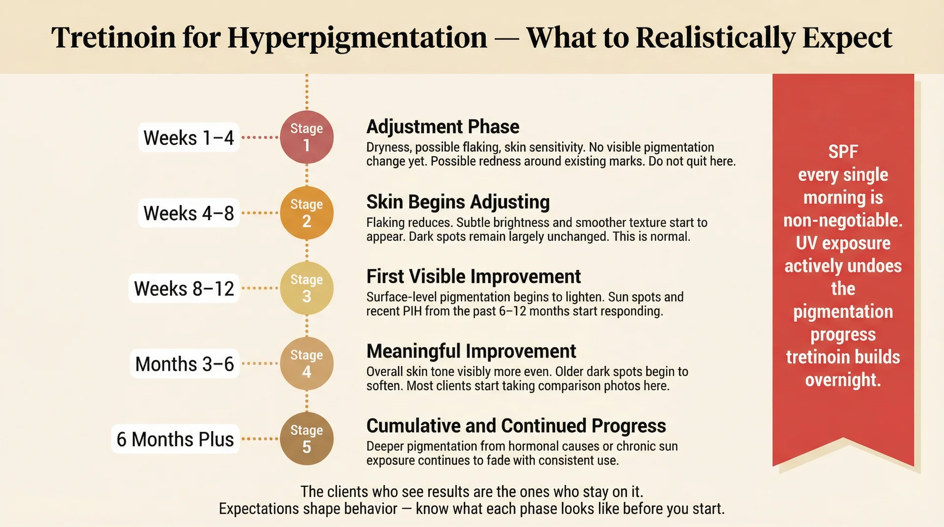 Vertical timeline infographic showing six stages of tretinoin results for hyperpigmentation from weeks 1 through 6 months plus