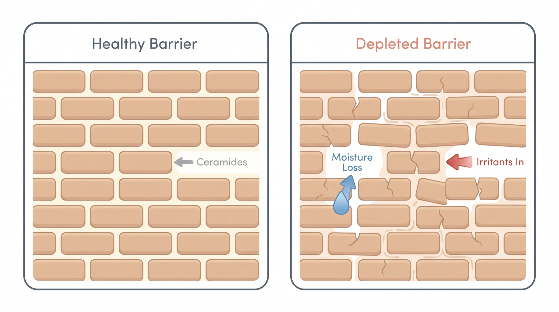 Diagram comparing intact skin barrier with ceramides versus depleted barrier with moisture-loss gaps
