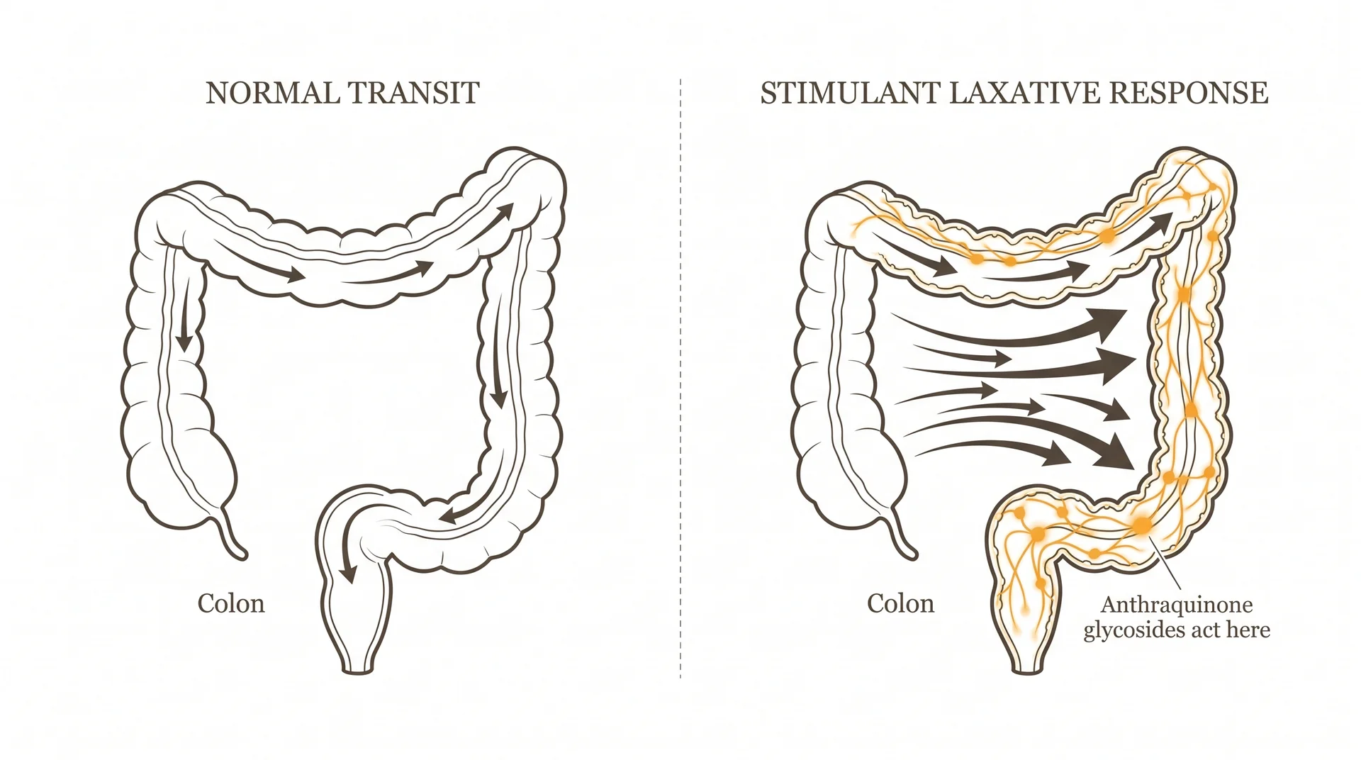 Diagram comparing normal colon transit with stimulant laxative response triggered by senna's anthraquinone glycosides.